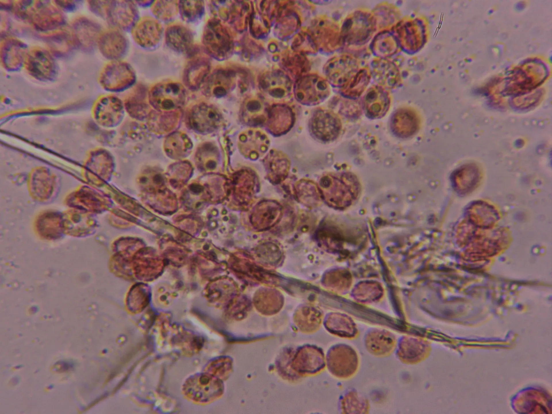 Microscopía de Lycogala epidendrum - 10 - X 1000
